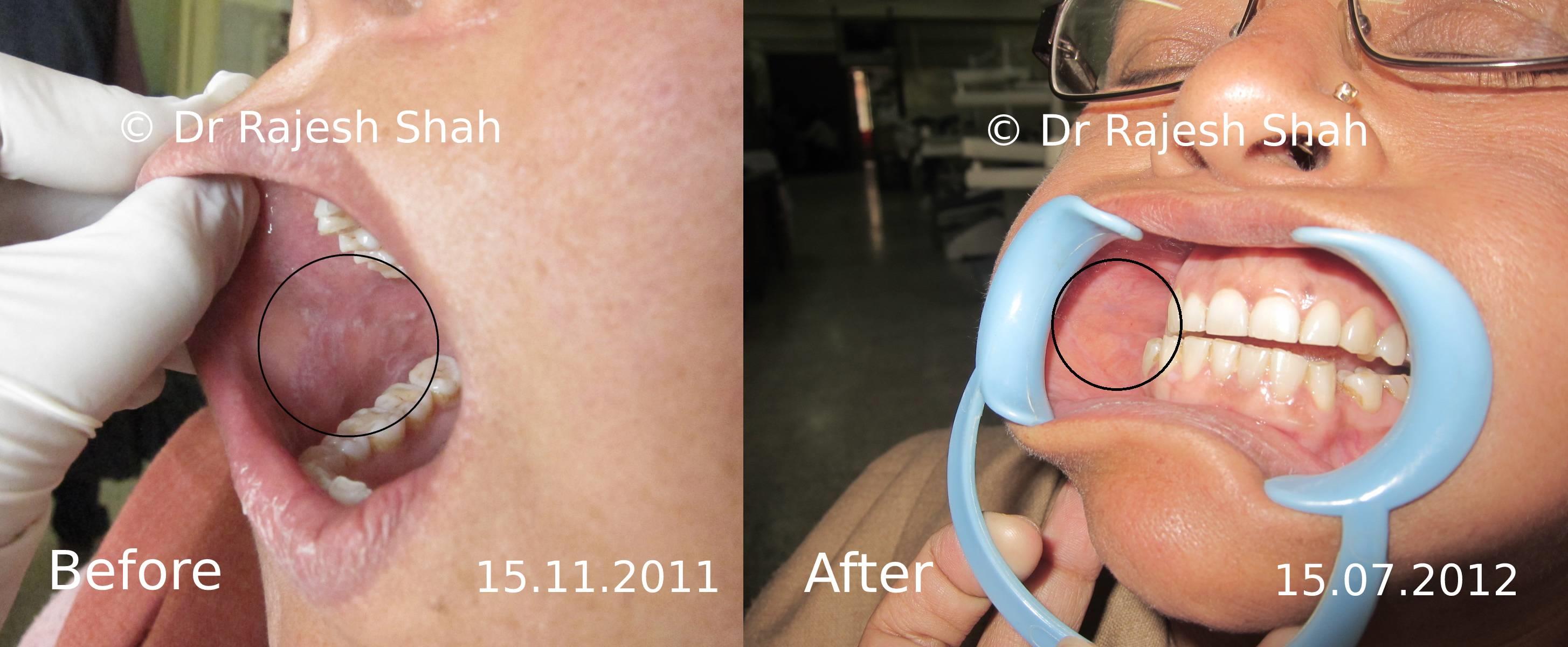 lifeforce homeopathy case-photos